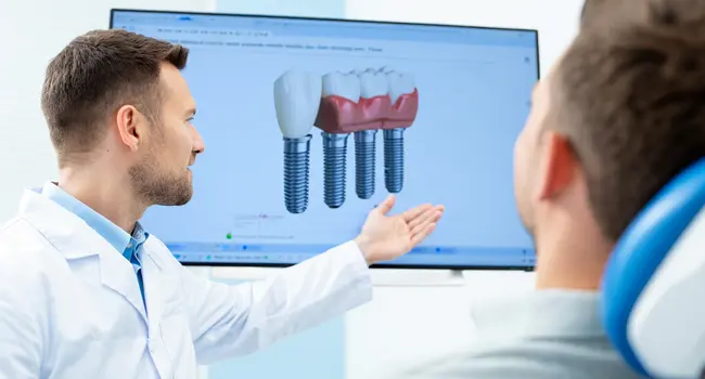 A dentist explains how to care for your teeth after the All-on-4 procedure