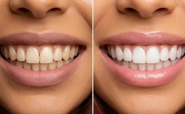 What procedures are available at our practice