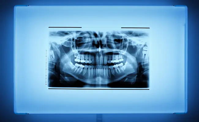 During the initial examination, we perform the tests