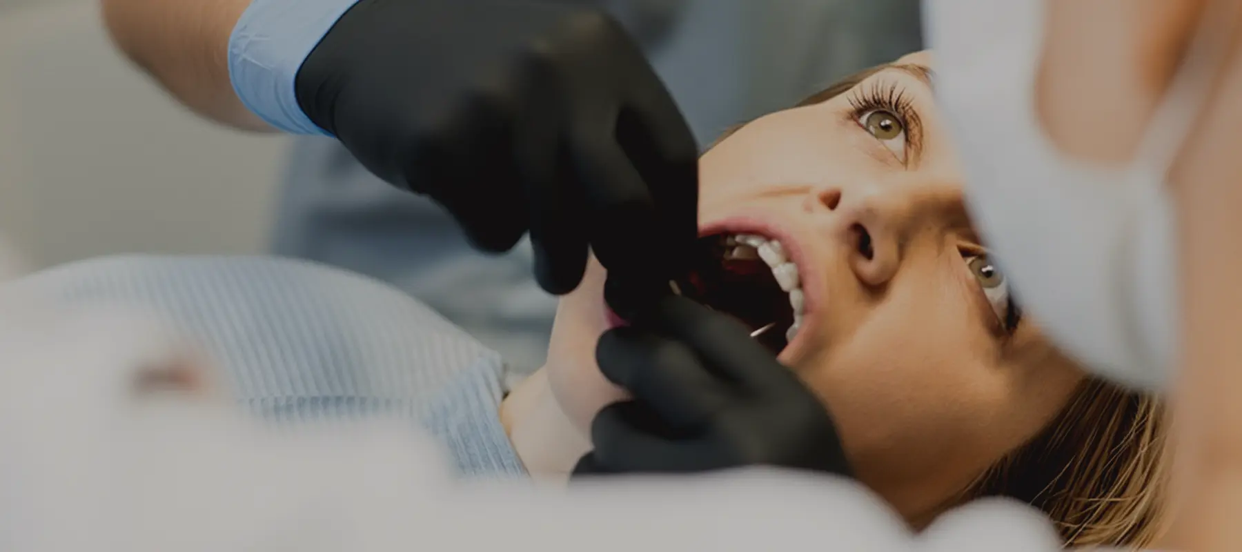 Tooth Extractions Arlington