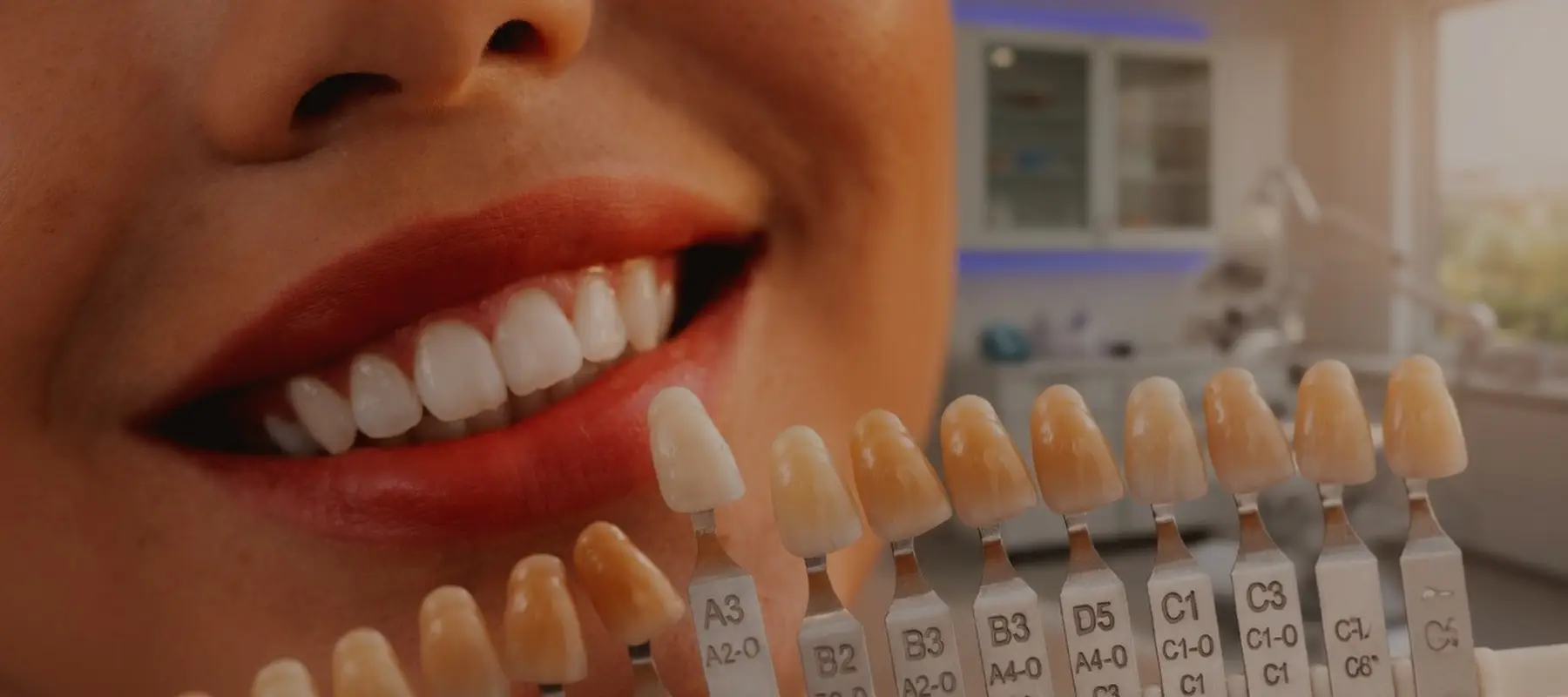Affordable Porcelain Veneers Arlington