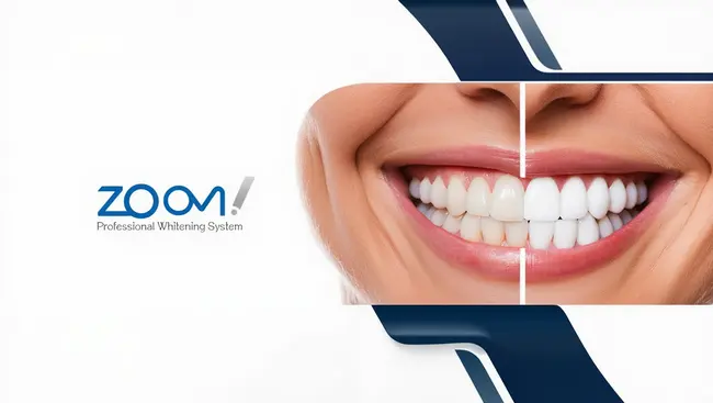 How Long Is The Procedure