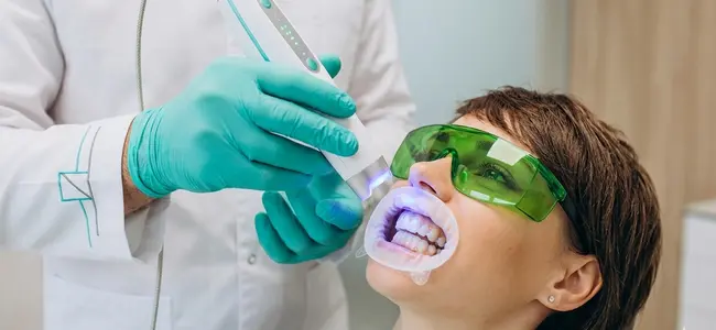 Professional Teeth Bleaching Safe